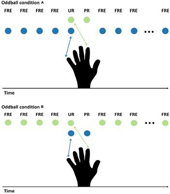 Magnetoencephalography Responses to Unpredictable and Predictable Rare Somatosensory Stimuli in Healthy Adult Humans